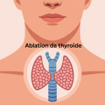 Illustration moderne ablation thyroide, cou et glande stylisés
