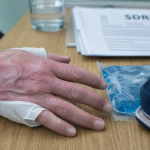 Algodisplasie : main immobilisée, gonflement et douleur persistante